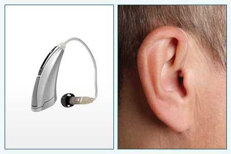 15 лучших слуховых аппаратов 2021. рейтинг, отзывы